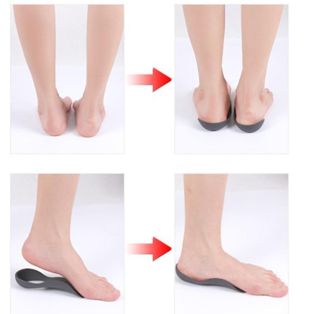 CLEARANCE- Arch Support Insole Leg Correction Flat Foot EVA Unisex Gel Pad Shoes Pad Shoes